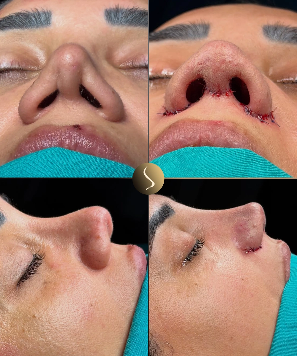 Ethnic Revision Before & After