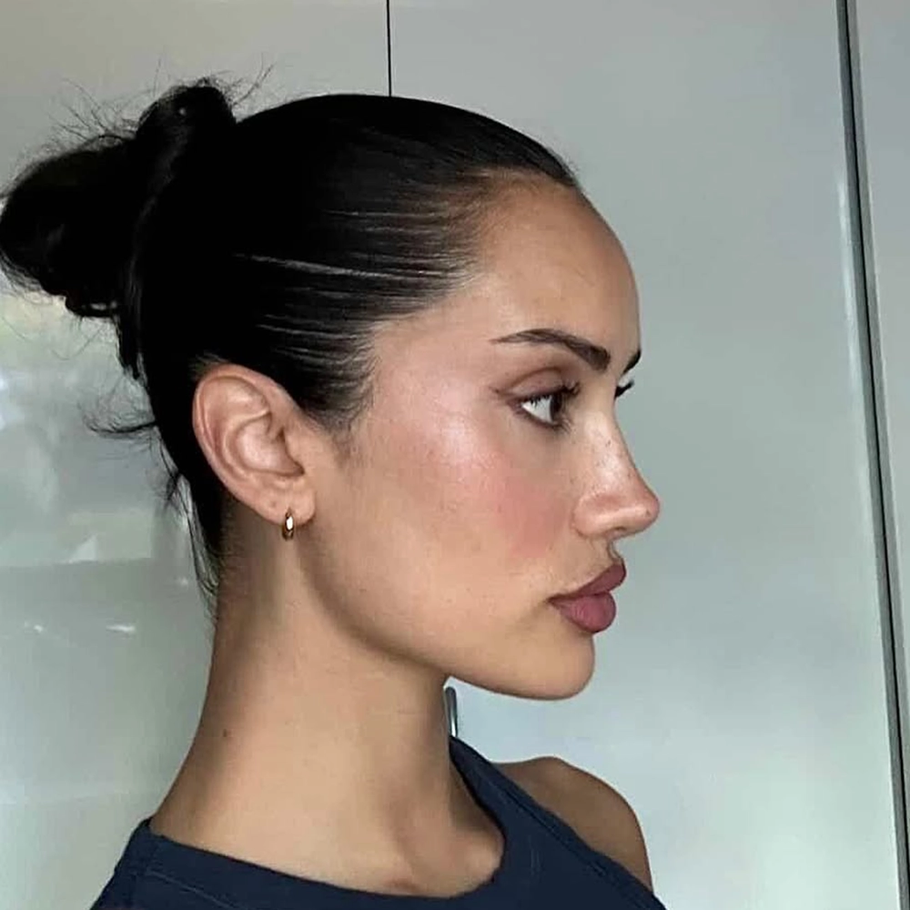 Revision Bridge Case